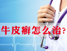 治疗牛皮癣的护理常识